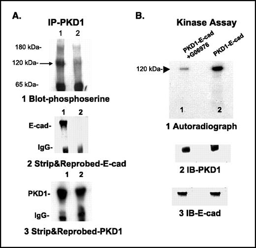 ECadherin Phosphorylation by Protein Kinase D1/Protein Kinase Cμ is