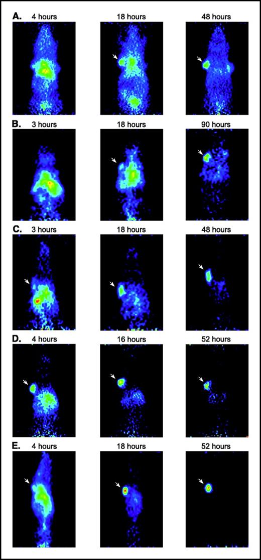 Figure 5. Coronal microPET images of five constructs in representative individual athymic mice bearing LS174T xenografts (left shoulder) and C6 (right shoulder, except D) at three different time points. Arrow, CEA-positive tumors. Following the imaging studies, tumors were dissected, weighed, and counted in a gamma counter. A, wild-type 42.5% ID/g, 185 mg LS174T tumor weight at 48 hours post injection; B, H435Q 10.6% ID/g, 64 mg at 123 hours; C, I253A 13.7% ID/g, 216 mg at 50 hours; D, H310A 10.6% ID/g, 174 mg at 53 hours; and E, H310A/H435Q 7.3% ID/g, 80 mg at 55 hours.