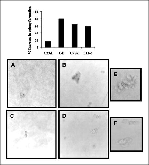 Figure 5. Estrogen leads to increased anchorage-independent growth. Anchorage-independent growth was measured by counting colony formation on agarose (top, columns). Estrogen treatment conditions and assay are described in Materials and Methods. Data are presented as the percentage of increase in colony number over vehicle-treated controls. CaSki (A), CaSki-Aro (B), C33A (C), and C33A-Aro (D) formed colonies on agarose as described in Materials and Methods. Note larger colony size in CaSki-Aro cells (E) as compared with C33A-Aro (F) cells.