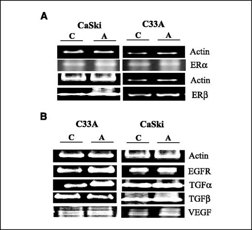 Figure 7. Estrogen-responsive genes are differentially regulated in HPV− and HPV+ cancer cells. RT-PCR was used to determine the effects of aromatase expression on ER-α and ER-β (A) and estrogen-responsive growth factors (B) in HPV− and HPV+ cervical cancer cell lines. RT-PCR conditions are described in Materials and Methods. C, untransfected control; A, aromatase-transfected cells (CaSki-Aro and C33A-Aro).