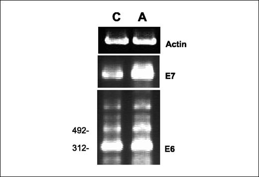 Figure 9. Aromatase induces HPV E6 and E7 oncogene expression. RT-PCR was used to determine the effect of aromatase on expression levels of E6 and E7 in CaSki and CaSki-Aro Cells. Primers and conditions used for cDNA amplification are described in Materials and Methods. C, untransfected CaSki control; A, CaSki-Aro cells.