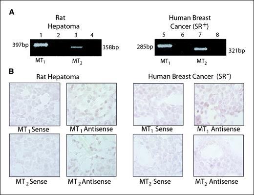 Figure 2. A, expression of MT1 and MT2 melatonin receptor mRNA transcripts in tissue-isolated rat hepatoma 7288CTC and SR+ MCF-7 human breast cancer xenograft tissue. Lane 1, reverse transcription-PCR reaction with rat hepatoma cDNA using primers specific for the rat MT1 melatonin receptor, yielding the expected 397-bp product. Lane 2, negative control reaction with the MT1 primers using an equivalent amount of rat hepatoma total RNA. Lane 3, reaction with rat hepatoma cDNA using primers specific for the rat MT2 melatonin receptor, yielding the expected 368-bp product. Lane 4, negative control reaction with the MT2 primers using an equivalent amount of rat hepatoma total RNA. Lane 5, reaction with human breast cancer xenograft cDNA using primers for the human MT1 melatonin receptor, yielding the expected 285-bp product. Lane 6, negative control reaction with MT1 primers using an equivalent amount of human breast cancer xenograft total RNA. Lane 7, reaction with human breast cancer xenograft cDNA using primers specific for the human MT2 melatonin receptor, yielding the expected 321-bp product. Lane 8, negative control reaction with MT2 primers using an equivalent amount of human breast cancer xenograft total RNA. B, representative photomicrographs showing in situ hybridization of tumor tissue from tissue-isolated rat hepatoma 7288CTC and an SR− MCF-7 human breast cancer xenograft tissue using digoxigenin-labeled sense and antisense oligonucleotides specific for either MT1 or MT2 melatonin receptors. Hybridization signal for the antisense MT1-specific oligonucleotide was found in both rat hepatoma and human breast cancer, whereas only hepatoma showed specific hybridization signal with the MT2 antisense-specific oligoprobe.
