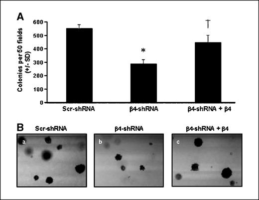 Figure 4. The α6β4 integrin is required for anchorage-independent survival and growth in the SUM-159 breast carcinoma cell line. A, the Scr-, β4-, and β4-shRNA + β4 cell lines were grown in complete medium containing 0.3% agar for 2 weeks. Columns, mean number of colonies formed from two independent experiments; bars, ± SD. Experiments were done in triplicate and 50 fields per well were counted. The number of colonies formed was significantly less for β4-shRNA cells than for Scr-shRNA cells (*, two-tailed t test, P < 0.001), whereas reexpression of β4 led to a significant increase in colony number compared with the β4-shRNA cell line (†, two-tailed t test, P = 0.005). B, representative bright-field images captured at ×4 magnification, showing that the colonies formed by the β4-shRNA cells (b) were considerably smaller than the colonies formed by either the Scr-shRNA (a) or β4-shRNA + β4 (c) cell lines.