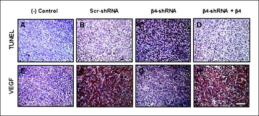 Figure 5. Increased apoptosis and decreased VEGF in mammary tumors formed in β4-shRNA–injected mice. Assessment of the level of cell death (A-D) occurring in the mammary tumors that formed following orthotopic injection of the Scr-shRNA (B), β4-shRNA (C), and β4-shRNA + β4 (D) cell lines was determined by TUNEL labeling. The red-brown staining is indicative of apoptosis and is dramatically enhanced in the tumors formed following injection of the β4-shRNA cell line (C) compared with either the Scr-shRNA (B) or β4-shRNA + β4 cell lines (D). A, β4-shRNA tumor incubated in the absence of terminal transferase enzyme as a negative (−) control. VEGF immunohistochemistry (E-H) done on tumors resulting from injection of Scr-shRNA (F), β4-shRNA (G), and β4-shRNA + β4 (H) cell lines revealed a much higher level of VEGF expression in the Scr-shRNA (F) and β4-shRNA + β4 (H) tumors than in the β4-shRNA (G) tumors. E, an isotype or negative (−) control-labeled sample obtained from a Scr-shRNA–injected mouse. Representative of data observed in three independent experiments that were done on a minimum of four separate mammary tumors obtained from each cell line. Bar, 50 μ.