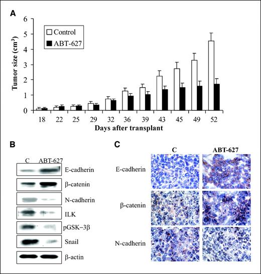 Figure 4. Blockade of ETAR by ABT-627 reverses EMT in vivo and inhibits tumor growth. A, antitumor activity of ABT-627 treatment on established HEY human ovarian carcinoma xenografts. Mice were given injections of 1.5 × 106 HEY cells s.c. in the dorsal flank. After 7 days, the groups of 10 mice were treated i.p. for 21 days with drug vehicle or with ABT-627 (2 mg/kg/d). Three different experiments with a total of 20 mice for each experiment were done; bars, SD. ABT-627 caused a significant inhibition of HEY tumor growth in treated animals over a 21-day dosing regimen. The comparison of time course of tumor growth curves by two-way ANOVA with group and time as variables showed that the group-by-time interaction for tumor growth was statistically significant (P < 0.001). B, immunoblotting for E-cadherin, N-cadherin, β-catenin, Snail, pGSK-3β, and ILK expression in HEY tumor xenografts. C, comparative immunohistochemical analysis of E-cadherin, N-cadherin, and β-catenin expression in HEY tumor xenografts (original magnification, ×320; N-cadherin, ×400).