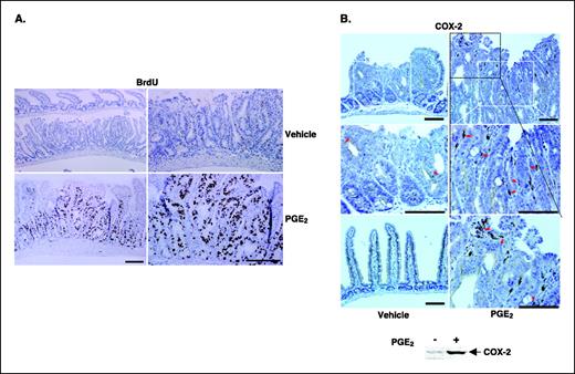 Figure 1. PGE2 induces intestinal epithelial cell proliferation and COX-2 expression in adenomas. Sections of small intestine were immunostained with anti-BrdUrd antibody (A) or COX-2 antibody (B). Representative section shows strong immunoreactive staining (brown) for incorporated BrdUrd in epithelial cells of adenomas taken from mice treated with PGE2 and weak staining was found in the adenomas from mice treated with vehicle alone. B, levels of COX-2 expression in the adenomas from mice treated with PGE2. Top, immunoreactive staining (brown) for COX-2. Bar, 100 μm. Bottom, three different Western blot experiments with similar results.