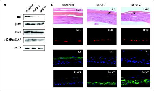 Figure 3. Knockdown of Rb is sufficient to up-regulate AKT activity in HFK. A, primary HFKs were transduced with retrovirus expressing two different shRNAs targeting Rb (shRb1 and shRb2) as well as a shRNA targeting no known gene (shScram) as control. Western blot analysis was done to measure the amount of knockdown of Rb. The relative knockdown of Rb, determined by densitometry analysis, was ∼70% and 80% for shRb1 and shRb2, respectively. The levels of Rb family members p107 and p130 are unaltered. p120RasGAP and actin are loading controls. B, cells were then differentiated on organotypic raft cultures for 14 days. Cells were pulsed with 20 μmol/L BrdUrd 12 hours before harvesting rafts. The rafts were then fixed, paraffin embedded, sectioned, and stained for BrdUrd (red), keratin-1 (green), phosphorylated AKT (green), and DAPI (blue) to stain nuclei. H&E-stained sections for all cell lines to examine morphology.