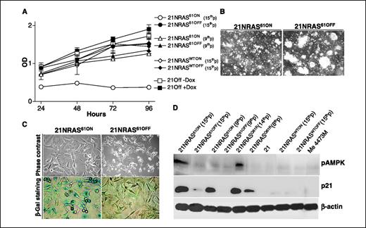 Figure 4. Differential growth characteristics and expression of senescence-associated markers in 21NRAS61ON and 21NRAS61OFF cells. A, proliferation, evaluated by MTS assay, of 21NRAS61ON and 21NRAS61OFF (at both the 9th and at the 15th in vitro passage), of 21NRASWTON and 21NRASWTOFF (at the 15th in vitro passage), and of 21Off cells cultured with/without doxycycline (Dox; 1 μg/mL). Points, mean A490 nm (OD) of triplicates of one of three experiments; bars, SD. A490 nm values of 21NRAS61ON at the 15th in vitro passage were significantly different at all time points from those of the other samples (ANOVA followed by SNK test, 0.001 < P < 0.05). B, growth in Matrigel for 1 week of 21NRAS61ON and 21NRAS61OFF cells at the 15th in vitro passage. Magnification, ×40. C, morphology and senescence-associated β-Gal activity of 21NRAS61ON compared with 21NRAS61OFF cells at the 15th in vitro passage. D, Western blot analysis of 21NRAS61ON and 21NRAS61OFF at both the senescent (15th) and nonsenescent (9th) in vitro passage, of constitutive transfectant 21NRASQ61R at both senescent (14th) and nonsenescent (8th) in vitro passage, of clone 21 (BRAFV600E), of 21NRASWTON and 21NRASWTOFF at the 15th in vitro passage, and melanoma Me 4473M (NRASQ61R) for expression of phospho-AMPK (pAMPK), p21, and β-actin (as loading control).