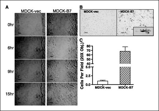 Figure 4. Overexpression of HOXB7 increases cell migration and invasion ability. A, wound healing assay with MDCK-vec and pooled MDCK-B7 cells. Microscopic observations were recorded 0, 6, 9, and 15 hours after scratching the cell surface. B, the cells were placed in a three-dimensional Matrigel invasion chamber and cells that invaded through Matrigel were fixed, stained with crystal violet, and counted. Arrow, a lamellipodia structure. Inset, higher magnification. C, number of cells that invaded through the Matrigel was counted in 10 fields under 20× objective lens. Bars, SD.