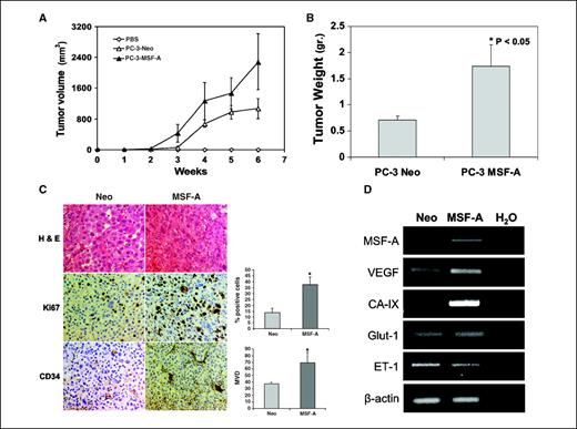 Figure 3. MSF-A expression promotes tumor growth and angiogenesis in a prostate cancer xenograft model. A prostate cancer xenograft model was established using PC-3-Neo and PC-3-MSF-A cells (3 × 106) implanted s.c. into the right hind of nude mice. PBS was used as a negative control. Animals were monitored for tumor volume measurements (A), sacrificed after 6 weeks, and tumors were processed for tumor weight measurements (B), immunohistochemical staining (C), and RT-PCR analysis (D). A, tumor volume measurements were calculated using the formula width2 × length × 0.52. Points, mean of representative experiments (n = 5); bars, SE. B, tumors were weighed immediately after dissection. Columns, mean (n = 5); bars, SE. *, P < 0.05. C, sections from both PC-3-Neo and PC-3-MSF-A tumors were subjected to H&E and immunostaining with Ki67 and CD34 as indicated. Right, top, Ki67 staining (%) was quantified by dividing the number of positive nuclei by the number of total nuclei in a ×40 magnification field multiplied by 100. Samples consisted of five paraffin-embedded tumor sections from each animal per group. Columns, average of the means of Ki67 staining from each animal (n = 5); bars, SE. *, P < 0.05. Right, bottom, microvessel density was determined by counting the capillaries positive for CD34 staining in ×4 magnification field per total section area (excluding necrotic areas) in five paraffin-embedded tumor sections from each animal per group. Columns, average of the means of microvessel density from each animal (n = 5); bars, SE. *, P < 0.05. D, a representative RT-PCR analysis of RNA isolated from either PC-3-Neo or PC-3-MSF-A tumors. The primers used were specific for the indicated mRNA.