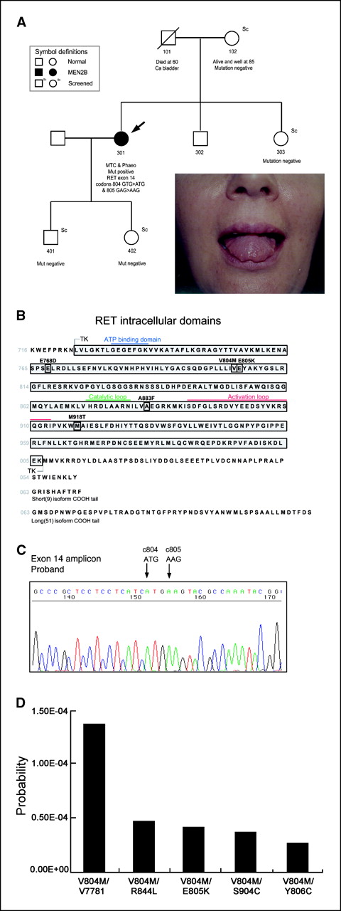 Figure 1. Clinical molecular genetics of the patient. A, pedigree of the MEN 2B family (arrow, proband); clinical features of MEN 2B (bumpy lips and tongue) in the proband. B, the location of the tandem mutations in the RET intracellular TK domain (circled). C, DNA sequencing of one allele of the proband's subcloned DNA revealed the presence of tandem missense mutations at codons 804 and 805 in exon 14 of the RET gene. D, MAPP-based P values of substituted RET variants quantify their predicted phenotypic effect. Tandem mutations identified in FMTC are less radical than those identified in MEN 2B. Columns, P values of five RET tandem mutants, from left to right: RETV804M/V778I and RETV804M/R844L, identified in FMTC, and RETV804M/E805K, RETV804M/S904C, and RETV804M/Y806C, identified in MEN 2B.