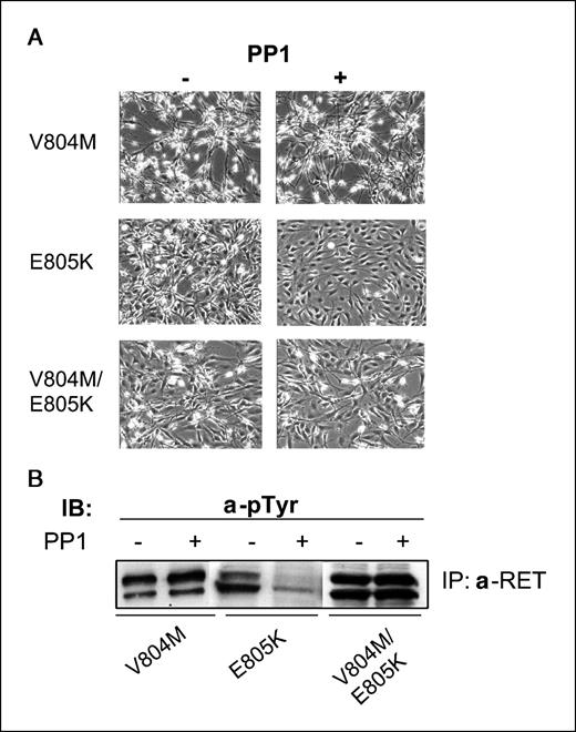 Figure 3. Effects of PP1 on RETV804M-, RETE805K-, and RETV804M/E805K-transformed cells. A, PP1 reverts the transformed morphology of RETE805K, but not that of RETV804M and RETV804M/E805K mutant NIH-3T3 fibroblasts. B, PP1 induces the dephosphorylation of RETE805K but not RETV804M or RETV804M/E805K. Anti-RET immunocomplexes (IP) for RETV804M-, RETE805K-, and RETV804M/E805K-expressing fibroblasts.