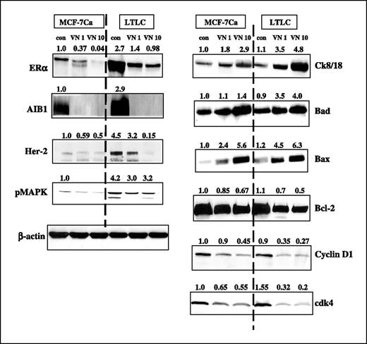 Figure 5. Effect of VN/14-1 on protein expression of ERα, AIB1, HER-2, pMAPK, cytokeratins 8 and 18, Bad, Bax, Bcl2, cyclin D1, and CDK4 in MCF-7Ca and LTLC cells. Western immunoblotting analysis of whole-cell lysates from MCF-7Ca and LTLC cells cultured in vitro. Left, ERα at 66 kDa, AIB1 at 160 kDa, HER-2 at 180 kDa, and pMAPK at 4,442 kDa; right, cytokeratins 8 and 18 at 47 kDa, Bad at 23 kDa, Bax at 20 kDa, Bcl2 at 28 kDa, cyclin D1 at 36 kDa, and CDK4 at 30 kDa. Left and right, lane 1, MCF-7Ca cells (control); lanes 2 and 3, 1 and 10 μmol/L VN/14-1 in MCF-7Ca cells; lane 4, LTLC cells (control); lanes 5 and 6, VN/14-1 treatments at 1 and 10 μmol/L in LTLC cells. Experimental protocol was as described in Materials and Methods. Blots were stripped and probed for β-actin to verify equal amount of protein loaded in each lane. Blots are representative of three independent experiments.