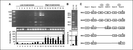 Figure 1. KLK8 expression profiles in different cancer cell types with different degrees of invasiveness. A, KLK8 expression was examined in the following cell lines: 1, SK-BR3; 2, T47D; 3, ZR-75-1; 4, Colo320DM; 5, Colo320HSR; 6, WiDr; 7, LoVo; 8, OVCAR-3; 9, A59; 10, HT1197; 11, HT1197-4; 12, Hs578T; 13, ES2; 14, PA1; 15, A59-4; 16, EJ; 17, NTUB1; 18, A549; and 19, H928. The invasiveness of these cell lines was normalized by setting the invasion rate of the highly invasive CL1-5 lung adenocarcinoma cell line to 100%. This separated the 19 cell lines into two groups: weakly invasive, with an invasiveness of <50% (1–11); and highly invasive, with an invasiveness of >50% (12–19). B, KLK8 expression was examined in two lung adenocarcinoma cell lines with different degrees of invasiveness (CL1-0, weakly invasive; CL1-5, highly invasive). Top, expression profile of KLK8. Middle, expression of GAPDH (internal control). Bottom, percentage of invasiveness of the cell lines determined by Matrigel analysis and compared with CL1-5 as 100%. Cell lines 1 to 3 and 12 are breast cancer cell lines; 4 to 7 are colon cancer cell lines; 8, 9, and 13 to 15 are ovarian cancer cell lines; 10, 11, 16, and 17 are bladder cancer cell lines; and 18 and 19 are lung cancer cell lines. C, genomic structure of the different KLK8 splice variants. The exons and the number of nucleotides in each exon are indicated for each splice variant. The KLK8 gene is composed of six exons and five introns, and the first exon is noncoding. †, location of the start codon; *, location of the stop codon; H, D, and S, approximate amino acid locations of the characteristic catalytic triad of serine proteases.