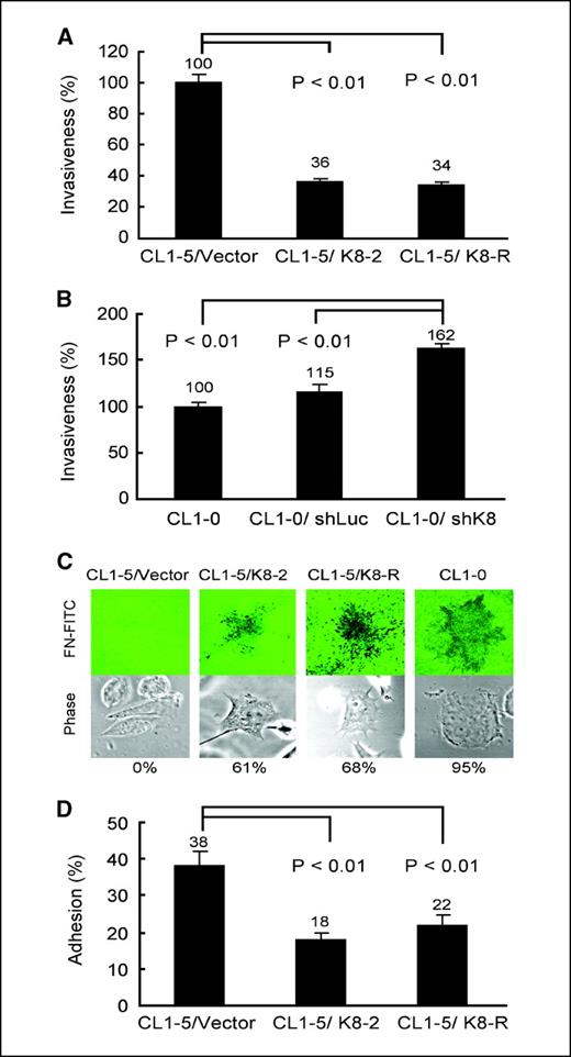 Figure 2. Association of KLK8 with cancer cell invasiveness. A, in vitro Matrigel invasion assay for CL1-5 cells transfected with different splice variants. The invasiveness of the different cell lines was normalized by that of CL1-5/Vector cells. B, in vitro Matrigel invasion assay for CL1-0 cells transfected with shLuc or shK8. The invasiveness was normalized by that of CL1-0 cells. C, degradation of FITC-conjugated fibronectin coated on coverslips by KLK8-transfected cells. The fluorescence images were taken with a confocal microscope. Degraded FITC-conjugated fibronectin (dark region under the cell). D, CL1-5 cells overexpressing KLK8 splice variants were assayed for adhesion to a fibronectin-coated substrate.