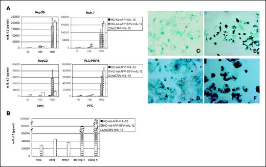 Figure 2. Specific expression of mIL-12 and β-galactosidase in hepatocellular carcinoma cells in vitro after infection with hybrid vectors. Four hepatocellular carcinoma cell lines (Hep3B, Huh-7, HepG2, and PLC/PRF/5) with AFP expression (A) and five hepatocellular carcinoma and non–hepatocellular carcinoma cell lines without AFP expression (HeLa, A549, MHC1, Sk-Hep-1, and clone 9; B) were infected with HC-Ad-AFP-mIL-12, HC-Ad-AFP-SFV-mIL-12, or control vector AdCMV-mIL-12 at different ppc (10, 100, and 1,000). After 2 days of infection, the supernatant was collected and the amount of mIL-12 was determined. C to F, two hepatocellular carcinoma cell lines (Hep3B and Huh-7) were infected with HC-Ad-AFP-LacZ or HC-Ad-AFP-SFV-LacZ at ppc 1,000. After 2 days of infection, the infected cells were stained with X-Gal. Microphotographs of cells infected with HC-Ad-AFP-LacZ (C and D) or HC-Ad-AFP-SFV-LacZ (E and F). C and E, Hep3B; D and F, Huh7.