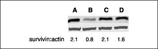 Figure 5. Lapatinib down-regulates survivin through proteosome-dependent degradation. BT474 cells were treated with lapatinib (500 nmol/L; B), lactacystin (5 μmol/L; C), and lapatinib + lactacystin (D). After 72 hours, cells were harvested, total cell lysate was prepared, and equal amounts of protein were separated by SDS-PAGE. Western blot analysis of survivin and actin steady-state protein levels. Untreated cells (A) served as controls. Blots were subjected to densitometry and absorbance values for survivin and actin were determined. The ratio of survivin/actin is indicated for each treatment condition.