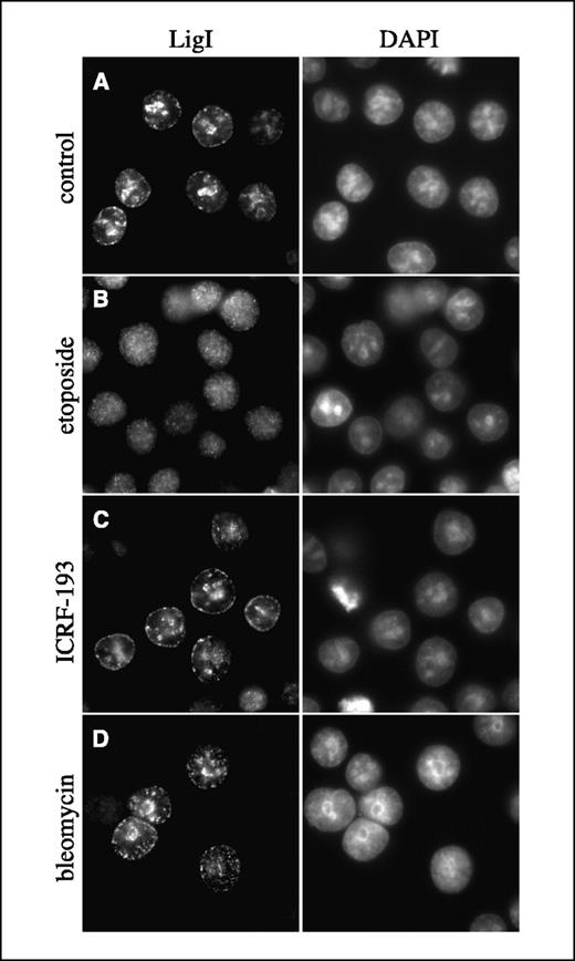 Figure 1. The dispersal of replication factories in response to different drugs. Exponentially growing HeLa cells were treated with the indicated drugs and stained with anti–DNA ligase I (LigI) polyclonal antibody and with TRITC-conjugated goat anti-rabbit IgG secondary antibody (left). Nuclei were counterstained with DAPI (right). Untreated control cells (A) and cells grown for 3 hours in 100 μmol/L etoposide (B), 100 μmol/L ICRF-193 (C), and 100 μg/mL bleomycin (D).