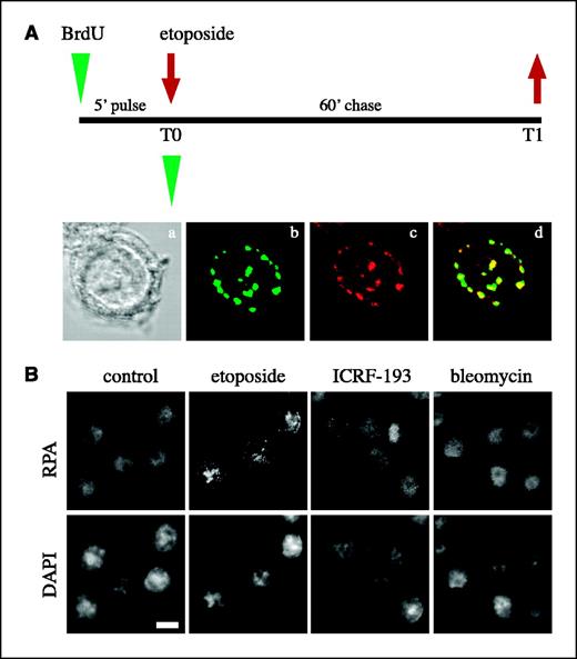 Figure 2. Etoposide-induced RPA2 foci colocalize with replicated chromatin. A, HeLa cells were pulse labeled for 5 minutes with BrdUrd (T0) and then chased for 60 minutes in fresh medium containing 100 μmol/L etoposide (T1). c, cells were stained with 9H8 mAb to RPA2 and with a TRITC-conjugated secondary antibody. b, the same cells were co-stained with Alexa Fluor 488–conjugated anti-BrdUrd mAb to detect sites of BrdUrd incorporation. d, confocal laser images of the same cell were taken and merged; yellow spots, RPA2-BrdUrd colocalization. a, differential interference contrast microscopy. B, exponentially growing HeLa cells were treated with the indicated drugs and stained with anti-RPA2 mAb. Nuclei were counterstained with DAPI. Conventional epifluorescence microscopy images of representative cell nuclei. Bar, 10 μm.