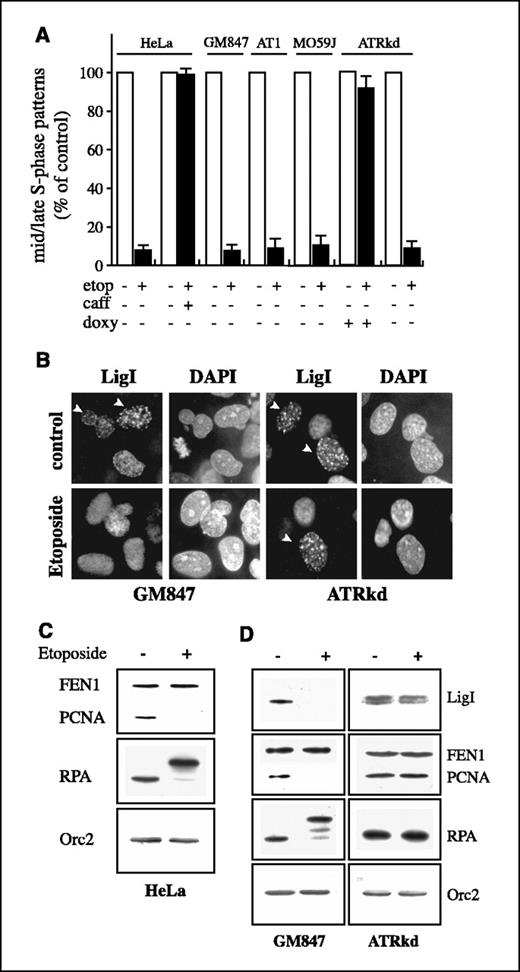 Figure 3. ATR kinase is required for the etoposide-mediated dispersal of replication factories. A, HeLa, GM847 control fibroblasts, ATM-defective cells (AT1), DNA-dependent protein kinase–defective cells (MO59J), and GM847/ATRkd cells (ATRkd) were incubated for 3 hours in the absence (□) or in the presence (▪) of 100 μmol/L etoposide and fixed. The distribution of DNA ligase I was revealed with anti–DNA ligase I polyclonal antibody. The distribution of DNA ligase I in GM847/ATRkd cells was studied both in the presence and in the absence of doxycycline required for the expression of ATRkd. The effect of caffeine on the etoposide response in HeLa cells was also shown. For each cell line, the number of nuclei displaying typical DNA ligase I mid/late S-phase patterns was counted in a pool of 500 randomly selected cells. The value measured after etoposide treatment was expressed as the percentage of the number of cells with mid/late S-phase patterns detected in untreated cells. Columns, mean of three independent experiments; bars, SE. B, immunofluorescence analysis of control cells (GM847) and ATRkd-expressing cells (ATRkd) grown in the presence or in the absence of etoposide (100 μmol/L) for 3 hours and then stained as described above. Nuclei were counterstained with DAPI. Arrowheads, cells in which DNA ligase I has typical mid/late S-phase pattern. C, etoposide induces the dissociation of replicative proteins from chromatin in HeLa cells. The chromatin fraction of cells untreated (−) or treated for 3 hours with 100 μmol/L etoposide (+) was analyzed by Western blotting with antibodies against the indicated proteins. D, etoposide induces the dissociation of replicative proteins from chromatin in an ATR-dependent manner. GM847 and ATRkd-expressing cells (ATRkd) untreated (−) or treated for 3 hours with 100 μmol/L etoposide (+). The chromatin fraction was analyzed by Western blotting with antibodies against the indicated proteins.