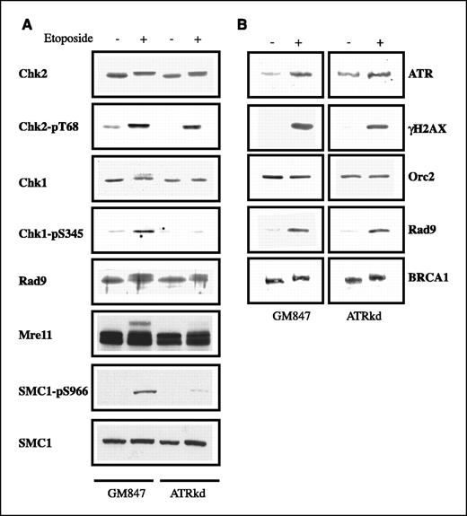 Figure 4. Response to etoposide in normal and ATRkd-expressing cells. GM847 control cells and ATRkd-expressing cells (ATRkd) untreated (−) or treated for 3 hours with 100 μmol/L etoposide (+). Total cell extracts (A) and chromatin fraction (B) were analyzed by Western blotting with antibodies against the indicated proteins or phosphoepitopes. ATR in GM847 control cells was revealed with Super Signal West Dura Extended substrate and in ATRkd-expressing cells with ECL.