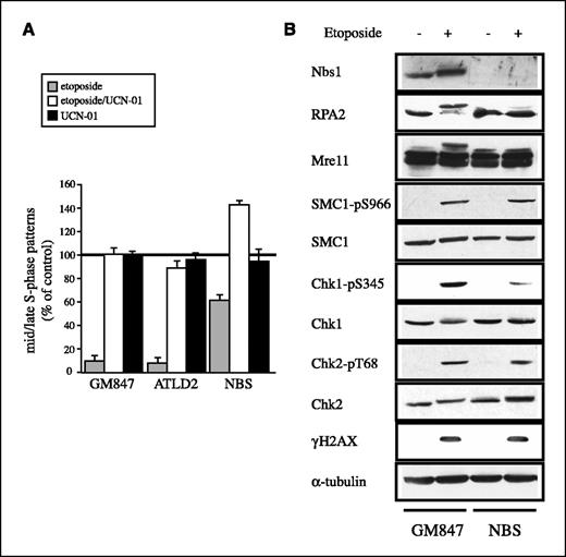 Figure 5. Nbs1 and Chk1 are required for the etoposide-induced dispersal of mid/late replication factories. A, mid/late S-phase replication factories after treatment with etoposide (), etoposide plus UCN-01 (□), or UCN-01 alone (▪) in GM847, ATLD2, and NBS cells. For each cell line, the number of nuclei displaying typical PCNA mid/late S-phase patterns was counted in a pool of 500 randomly selected cells. The value is expressed as the percentage of the number of cells with mid/late S-phase patterns detected in untreated cells. Columns, mean of three independent experiments; bars, SE. B, response to etoposide in normal and NBS cells. GM847 control cells and NBS cells untreated (−) or treated for 3 hours with 100 μmol/L etoposide (+). Total cell extracts were analyzed by Western blotting with antibodies against the indicated proteins or phosphoepitopes.
