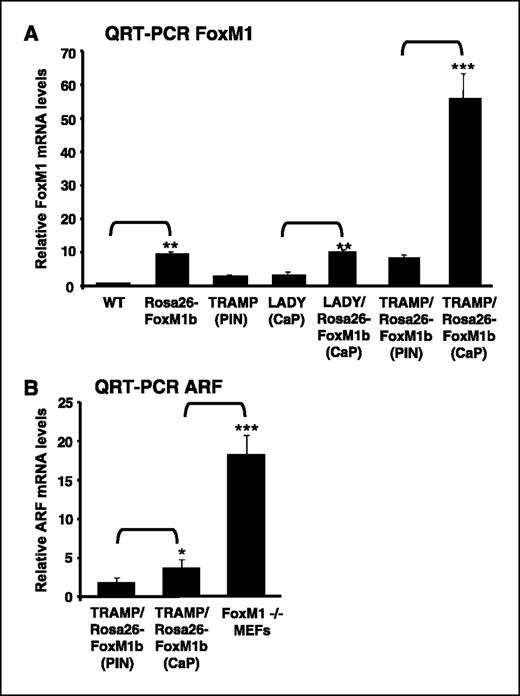 Figure 3. Significant increase in FoxM1 mRNA levels and sustained ARF tumor suppressor mRNA expression in prostate carcinomas. A, a 6-fold increase in FoxM1 mRNA levels was found in prostate carcinomas compared with PIN in TRAMP/Rosa26-FoxM1b double TG mice. Total RNA was prepared from either prostate carcinomas (CaP) or PIN in TRAMP/Rosa26-FoxM1b and LADY/Rosa26-FoxM1b double TG mice and TRAMP or LADY single TG mice. We also prepared total RNA from normal prostate tissue from wild type (WT) and Rosa26-FoxM1b TG mice. To determine relative levels of FoxM1 mRNA, QRT-PCR was done with RNA from either prostate tissue, carcinoma, or PIN and FoxM1-specific primers. B, prostate carcinomas in TRAMP/Rosa26-FoxM1b TG mice exhibit sustained expression of ARF tumor suppressor mRNA. Total RNA was prepared from either prostate carcinomas or PIN in TRAMP/Rosa26-FoxM1b double TG mice and analyzed for mRNA levels of the ARF tumor suppressor by QRT-PCR using primers specific to mouse ARF gene. Note that ARF mRNA levels in these prostate tumors were significantly less than those found in early passage FoxM1−/− mouse embryonic fibroblasts (MEF; B), which undergo premature senescence and express high levels of nuclear ARF protein (42). Levels of cyclophilin mRNA were used to normalize expression levels of FoxM1 and ARF mRNA as described in Materials and Methods. Statistically significant increases with Ps calculated by Student's t test: *, P < 0.05; **, P ≤ 0.01; ***, P ≤ 0.001.
