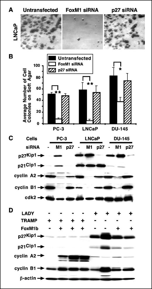 Figure 5. Depletion of FoxM1 reduces anchorage-independent growth of prostate cancer cell colonies on soft agar. The prostate cancer cell lines PC-3, LNCaP, and DU-145 were transfected with 100 nmol/L of either siFoxM1 #2 or siP27 duplexes or left untransfected. One day after transfection, the cells were trypsinized and plated on soft agar for 3 weeks to analyze the anchorage-independent cell growth as described previously (32). A, representative micrographs of LNCaP prostate cancer cell colonies on soft agar after transfection with the indicated siRNA or left untransfected. B, graphic presentation of the number of prostate cancer cell colonies that grew on soft agar with or without depletion of FoxM1 or p27Kip1 protein levels. Triplicate plates were used to count the number of cell colonies. Columns, mean number of colonies that grew on soft agar; bars, SD. FoxM1-depleted PC-3 (**, P = 0.003), LNCaP (**, P = 0.007), or DU-145 (*, P = 0.03) prostate cancer cells displayed a statistically significant decrease in the number of cell colonies that grew on soft agar compared with untransfected or siP27 transfected controls. C, FoxM1-depleted prostate cancer cell lines exhibit increased nuclear levels of CDKI proteins and diminished expression of cyclin A2 and cyclin B1 protein. PC-3, LNCaP, or DU-145 prostate cancer cells were transfected with siFoxM1 #2 or siP27 duplex or left untransfected (−) and nuclear extracts were prepared at 72 hours following transfection and analyzed for nuclear levels of p21Cip1, p27Kip1, cyclin A2, and cyclin B1 proteins by Western blot analysis. The protein levels of cdk2 were used as a loading control. D, increased proliferation in TRAMP/Rosa26-FoxM1b prostate carcinomas correlates with elevated expression of cyclin A2. Expression of p21Cip1, p27Kip1, cyclin A2, and cyclin B1 proteins was determined by Western blot analysis with prostate tissue extracts isolated at later time points from TRAMP or LADY single TG mice and TRAMP/Rosa26-FoxM1b or LADY/Rosa26-FoxM1b double TG mice.
