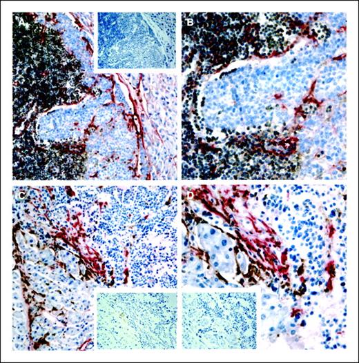 Figure 4. To show myofibroblast populations are distinct from cells of the hematopoietic lineage. A and B, tumor-involved pancreatic lymph node in a RIPTag mouse immunostained for CD45 (brown) and α-SMA (red; ×20). Although the two cell populations are in close proximity, they seem to be distinct. Inset, the same tumor infiltrated lymph node but omitting the primary antibody as a negative control for CD45 (×20). C and D, pancreas of a RIPTag mouse immunostained for F4/80, a mouse macrophage marker (brown), and α-SMA (red; ×20 and ×40). The tumor is seen to be invading the surrounding pancreas. The populations of F4/80-positive cells and α-SMA-positive cells are in close proximity but seem to be distinct. C and D, insets, the same tumor tissue but omitting the primary antibodies for F4/80 and α-SMA, respectively. All magnifications are objective magnifications.