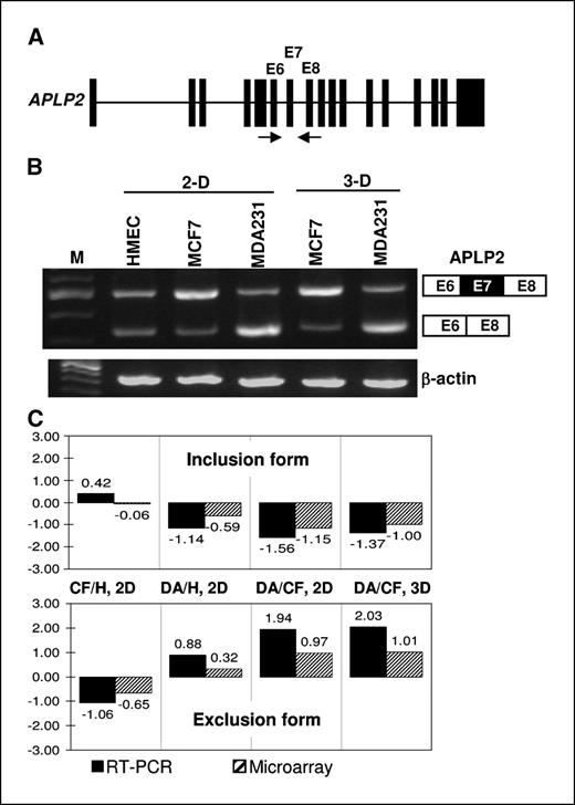 Figure 3. Alternative splicing of mRNA from the APLP2 gene in MCF7, MDA-MB-231, and HMEC cells. A, exon-intron arrangement of the APLP2 gene. Solid bars, exons. Lines between exons, introns. There are 17 exons in APLP2 gene. The constitutive exons e6 and e8 and the alternative exon e7 are indicated. Microarray probes are situated as shown in Fig. 1A. Arrows, the primer pair used in the PCR experiment. B, RT-PCR assays of alternative splicing of APLP2 mRNA. Total RNA was isolated from cells grown in two-dimensional or in three-dimensional culture as indicated and reverse transcribed to cDNA using oligo(dT) and random sequence oligos. cDNA was then amplified by PCR using e6 and e8 primers, and the products were resolved in 2% agarose gels. Top band, exon-inclusion form; bottom band, exon-skipping form, as indicated on the right. cDNA was also amplified using β-actin-specific primers for comparison. M, DNA size marker. C, comparison of inclusion or exclusion indexes from the RT-PCR results (solid columns) and from the microarray analysis (hatched columns). Top, the inclusion index from RT-PCR experiments was calculated as log2 of the ratio between the intensity (as percentage of the total) of the inclusion form of one sample and the intensity (as percentage of the total) of the inclusion form of another sample; the inclusion index for microarray experiments was calculated by taking log2 of the ratio between exon-inclusion junctions and constitutive exons. Bottom, the exclusion indexes were analyzed in a similar fashion except that the exclusion forms were analyzed. CF/H, 2D, MCF7 two-dimensional versus HMEC two-dimensional; DA/H, 2D, MDA-MB-231 two-dimensional versus HMEC two-dimensional; DA/CF, 2D, MDA-MB-231 two-dimensional versus MCF7 two-dimensional; DA/CF, 3D, MDA-MB-231 three-dimensional versus MCF7 three-dimensional.