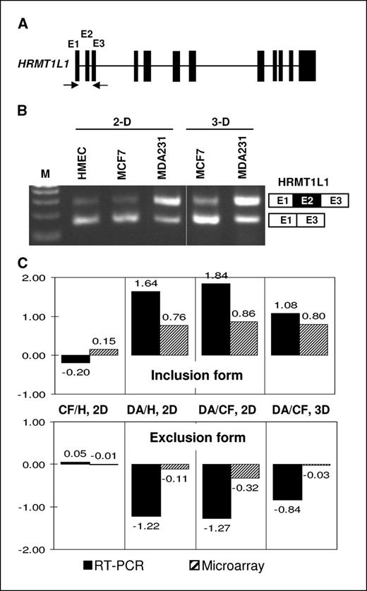Figure 4. Alternative splicing of mRNA from the HRMT1L1 gene in MCF7, MDB-MB-231, and HMEC cells. A, exon-intron arrangement of the HRMT1L1 gene. There are 12 exons in the HRMT1L1 gene. B, RT-PCR assays of alternative splicing of HRMT1L1 mRNA. C, comparison of inclusion or exclusion indexes from the RT-PCR results (solid columns) and from the microarray analysis (hatched columns). Samples were prepared and analyzed as described in Fig. 3.