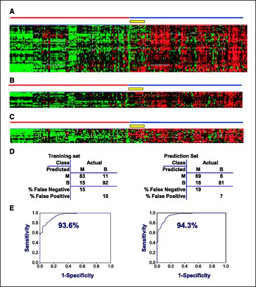 Figure 1. A, supervised hierarchical clustering based on 50 genes ranked according to the lowest P2s comparing benign and malignant tissue samples. Training set database: 210 samples used for the analysis plus 17 basal cell carcinomas (yellow box) and 19 duplicate samples obtained from the same patients that were excluded from the analysis but were used for display (Table 1). Data are according to the central method for display using a normalization factor as suggested by Ross et al. (24). Benign and malignant samples are marked with red and blue lines, respectively. B, 20 genes differentially expressed between malignant and benign lesions with the highest degree of significance (P < 1.75 × 10−16). Data as in (A). C, a seven-pair gene pairing class prediction test done on the 6,264 genes up-regulated in malignant tissue. Data as in (A). D, 2 × 2 table describing the 87% accuracy value obtained by plotting the seven gene pairs described in (B) in the training set (left) and in the prediction set (right) using SVM algorithm, where B is benign and M is malignant; accuracy in both case was 87%. E, ROC curves done using the seven gene pairs (left) or a set of 50 genes with the highest level of discrimination between malignant and benign samples. % Values represent the area below the curve (accuracy; ref. 23).