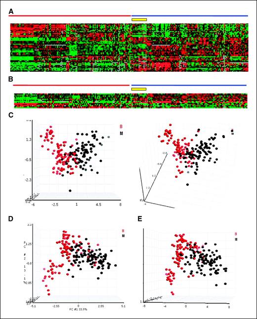Figure 2. A, supervised hierarchical clustering based on 50 genes ranked according to the lowest Ps comparing benign and malignant tissue samples. These genes were selected from a basis of 332 already proposed biomarker genes that were included in our arrays (Supplementary Data). Same training set database and additional samples described in Fig. 1A. Data are according to the central method for display using a normalization factor as suggested by Ross et al. (24). Benign and malignant samples are marked with red and blue lines, respectively. B, a seven-pair gene pairing class prediction test done on the 332 previously proposed biomarkers. Data as in (A). C to E, PCA based on the seven gene pairs (red circles, benign; blue circles, malignant samples) identified by analysis of the 6,264 genes up-regulated in cancer (C), seven gene pairs identified by the analysis of 332 known biomarkers (D), and using the combination of the two gene pairing results (E).