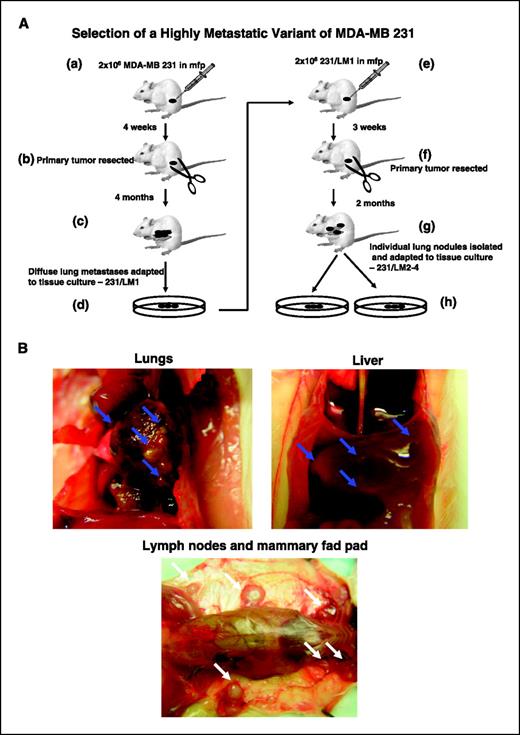 Figure 1. Procedures used for selecting the highly metastatic MDA-MB-231 human breast cancer variant, 231/LM2-4. MDA-MB-231 cells were injected into the MFPs of SB-17 SCID mice. The 231/LM2-4 variant was obtained subsequent to two rounds of lung metastasis selection in mice, after surgical removal of the primary orthotopically transplanted tumor, as explained in detail in the text and outlined in the diagram. A, primary tumors were removed when volumes reached ∼400 mm2. Six weeks later, mice were sacrificed and examined for the presence of macrometastases in the lungs, liver, lymph nodes, and MFPs. B, arrows, typical location of metastatic lesions. The sequence for the selection strategy was as follows: (a) 2 × 106 MDA-MB 231 cells were injected into the MFP of adult 6- to 8-week-old female CB17 SCID mice; (b) 4 weeks later, the primary tumor was resected fully by surgery when the tumor volumes were 300 to 500 mm3; (c) at monthly intervals, groups of mice were sacrificed and checked for presence of metastases in the lungs and full-blown diffuse metastatic spread was observed in the mice after 4 months; (d) the whole set of lungs from one mouse was adapted to tissue culture and grown for 3 passages to derive a line referred to as 231/LM1; (e) 2 × 106 231/LM1 cells were injected into the MFP of adult 6- to 8-week-old female CB17 SCID mice; (f) ∼3 weeks later, the primary tumor was resected when the tumor volume was 300 to 500 mm3; (g) again, at monthly intervals, groups of mice were sacrificed and checked for metastases in the lungs; 2 months after resection of the primary tumor, mice were observed to have numerous macroscopic lung nodules with some spilling into the pleural cavity; (h) several individual lung nodules were isolated and adapted to tissue culture to derive established lines, one of which, 231/LM2-4, was selected for in vivo studies. Overall, this selection procedure took almost 9 months to complete. Genotypic analysis of MDA-MB-231 and the 231/LM2-4 variant verified their human origin and lineage relationship (data not shown). Surgical resection of primary tumors was carried out by skin incision and carefully clearing all tumor tissue away from surrounding connective tissue. Weekly weight assessment was used as a surrogate marker for toxicity. The mice were sacrificed when tumor sizes reached 1.7 cm3.