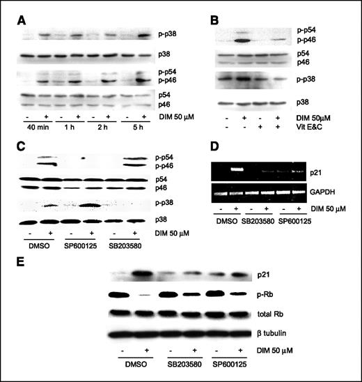 Figure 5. JNK and p38 pathways mediated 3,3′-diindolylmethane (DIM)–induced p21 overexpression. A, MCF-7 cells were treated with 3,3′-diindolylmethane (50 μmol/L) or vehicle DMSO for the indicated times, and Western blot was done as described in Materials and Methods. B, cotreatment with vitamins E and C prevented 3,3′-diindolylmethane-induced p38 and JNK phosphorylation as shown by Western blot analysis. C, pharmacologic inhibitors of JNK and p38 kinases prevented 3,3′-diindolylmethane-induced JNK and p38 phosphorylation as shown by Western blot analysis. MCF-7 cells were pretreated with 20 μmol/L SB203580 (p38 inhibitor) or 8 μmol/L SP600125 (JNK inhibitor) for 30 minutes before 1 hour of 3,3′-diindolylmethane treatment. D, pharmacologic inhibitors of JNK and p38 kinases prevented 3,3′-diindolylmethane-induced p21 mRNA up-regulation as shown by RT-PCR analysis. MCF-7 cells were pretreated with 20 μmol/L SB203580 (p38 inhibitor) or 8 μmol/L SP600125 (JNK inhibitor) for 30 minutes before 24 hours of 3,3′-diindolylmethane treatment. E, SB203580 and SP600125 prevented 3,3′-diindolylmethane-induced p21 overexpression at the protein level and reversed 3,3′-diindolylmethane-induced Rb hypophosphorylation as shown by Western blot analysis.