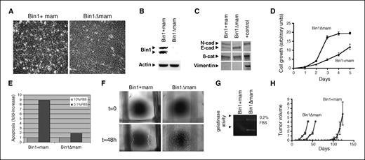 Figure 4. Advanced neoplastic character of MMECs established from DMBA-induced mammary tumors lacking Bin1. A, morphology. Cells were photographed using phase optics. B, Bin1 status in representative pair of MMEC tumor cell lines. Total cellular protein was extracted MMEC tumor cell lines and Bin1 status was monitored by Western blot analysis. C, epithelial character of MMEC tumor cell lines. Western blot analysis of cellular protein extracts for the epithelial markers E-cadherin and β-catenin and the mesenchymal markers N-cadherin and vimentin was done. D, proliferation. Cells were seeded into growth medium and viable cell count was determined at the times indicated. Relative outgrowth. E, resistance to apoptosis triggered by serum deprival. Cells were seeded overnight into growth medium and then incubated in medium containing 0.1% FBS before being harvested 48 h later for flow cytometric analysis. Relative levels of apoptosis were defined by the proportion of the cellular population exhibiting sub-G1–phase DNA profile. F, motility. Cells were incubated as above, except that the monolayer was scratched with a pipette tip before photomicrography 24 h later. G, MMP-9 zymogram. Cells were incubated as above before preparation and analysis of protein extracts. H, graft tumor formation. Two tumor cell populations of each genotype (107 cells each) were injected orthotopically into the mammary fat pads of syngeneic FVB × B6 offspring of FVB-N and C57BL/6J breeders or into immunocompromised CD-1 nude (Crl:CD-1-nuBR) mice. Tumor growth was monitored by caliper measurements, and final volume and wet weight were determined at necropsy.
