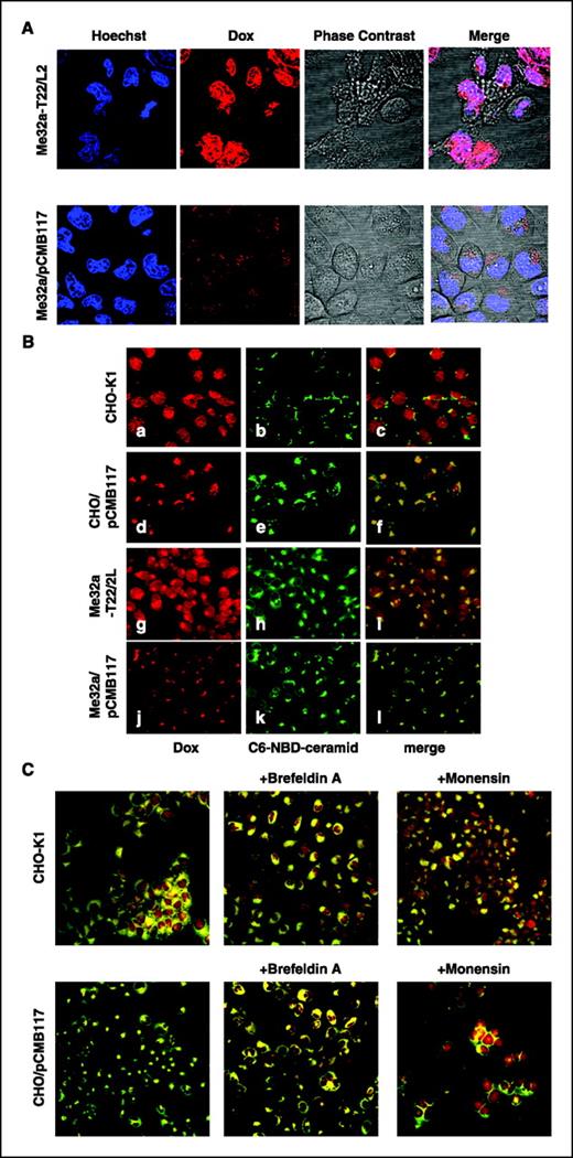 Figure 2. Effect of ATP7A expression on intracellular localization of doxorubicin. A, Me32a-T22/L2, parental cells, and Me32a/pCMB117, ATP7A-expressing cells, were incubated with 20 μmol/L doxorubicin (Dox) in DMEM/10% FCS for 30 min and 2 μg/mL Hoechst 33342 was added and cells were incubated for 30 min more. Doxorubicin (red; middle left), Hoechst 33342 (blue; left), and phase-contrast image (middle right) of the same field were merged (right). B, CHO-K1 (a–c), CHO/pCMB117 (d–f), Me32a-T22/L2 (g–i), and Me32a/pCMB117 (j–l) cells were incubated with 20 μmol/L doxorubicin (red; a, d, g, and j) and the Golgi marker, 5 μmol/L C6-NBD-ceramide (green; b, e, h, and k). Right, c, f, i, and l, merged images. C, CHO-K1 (top) and CHO/pCMB117 (bottom) cells were incubated with doxorubicin (red) and with the Golgi marker C6-NBD-ceramide (green) in the absence (left) and presence of brefeldin A (middle) or monensin (right), and the merged images are shown.
