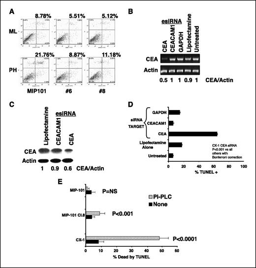 Figure 2. CEA protects CRC cells from anoikis. A, MIP-101 (CEA negative), MIP-101 clone 6, and MIP-101 clone 8 (both CEA positive) cells were grown under monolayer (ML) or PH conditions for 24 h, after which cells were collected and stained with Annexin V/propidium iodide for detection of apoptosis by flow cytometry. Apoptotic populations are the sum of the top (late apoptotic) and bottom (early apoptotic) right quadrants. Stable expression of CEA protects MIP-101 cells from anoikis. B, CX-1 cells were transfected with 50 nmol/L of esiRNA for 48 h, after which total RNA was collected and mRNA levels of CEA were assessed. Actin mRNA levels were used as equal loading controls. Quantification using NIH ImageJ shows a 50% decrease in CEA mRNA levels 48 h after esiRNA transfection. C, total protein extracts were collected from CX-1 cells transfected with 50 nmol/L of the indicated esiRNA for 48 h. Protein (30 μg) was separated by SDS-PAGE, transferred to membranes, and blotted for CEA and actin. Quantification using NIH ImageJ shows a 40% decrease in CEA protein levels 48 h after esiRNA transfection. D, CX-1 cells were transfected with the same esiRNA as in B and C for 48 h, after which 2 × 104 cells were transferred to PH-coated 96-well plates and grown in suspension for an additional 48 h. The cells were then collected and processed for TUNEL staining. More than 300 nuclei were counted per condition. Columns, Mean percentages of cells by TUNEL; bars, SD. Asterisk indicates P < 0.001 versus all others by contingency analysis with Bonferroni correction. E, CEA-positive MIP-101 clone 8 and CX-1 cells were cultured for 72 h in suspension in the presence of either 250 milliunits/mL of PI-PLC or PBS. The cells were then collected and processed for TUNEL staining. Removal of CEA from cell surface increases anoikis.