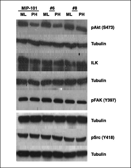Figure 3. CEA has no effect on participants in integrin signaling in MIP-101, clone 6, or clone 8 cells. MIP-101 and its CEA-expressing clones 6 and 8 were cultured in monolayer or PH for 24 h, after which total protein was extracted, separated by SDS-PAGE, and probed for pAKT, ILK, pFAK, and pc-Src. β-Tubulin levels were used to control for equal protein loading. The expression of CEA is not associated with a specific effect on participants in integrin signaling.
