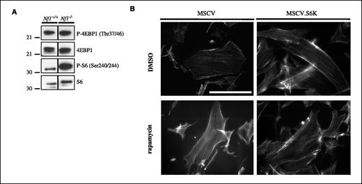 Figure 2. Decreased stress fiber formation in Nf1−/− astrocytes occurs independent of 4EBP1/S6K signaling. A, 4EBP1 phosphorylation (Thr37/Thr46) is similar in wild-type and Nf1−/− astrocytes, whereas S6 phosphorylation (Ser240/Ser244) is increased in Nf1−/− astrocytes. Black line, lysates from wild-type (Nf1+/+) and Nf1−/− astrocytes were run on the same gel in nonconsecutive lanes. B, overexpression of S6K in wild-type astrocytes did not alter actin stress fiber formation in wild-type or Nf1−/− astrocytes using phalloidin cytochemistry. Bar, 200 μm. Magnification, ×20. *, P < 0.05.