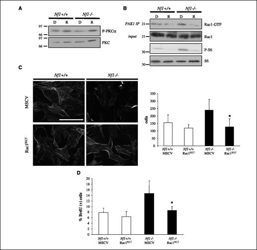 Figure 3. mTOR-dependent Rac1 hyperactivation is required for decreased actin stress fiber formation in Nf1−/− astrocytes. A, the expression of activated PKCα (Thr638/Thr641) is similar in wild-type and Nf1−/− astrocytes. Immunoblotting for total PKCα serves as a protein loading control. B, GTP-bound Rac1 was immunoprecipitated from wild-type and Nf1−/− astrocytes treated with DMSO vehicle or 10 nmol/L rapamycin using PAK1-PBD affinity chromatography. Equal protein loading was confirmed by immunoblotting for total Rac1 from a lysate aliquot before precipitation. GTP-bound Rac1 was increased in Nf1−/− astrocytes. Rac1 activation and S6 phosphorylation, but not total protein (Rac1, S6) expression, are blocked by rapamycin treatment. C, expression of a dominant-negative Rac1 mutant (Rac1N17) restores actin stress fiber formation (phalloidin) and cell motility in Nf1−/− astrocytes to wild-type levels using phalloidin immunochemistry and Boyden chamber motility assay, respectively. D, expression of Rac1N17 in Nf1−/− astrocytes decreases cell proliferation as determined by BrdU incorporation. Bar, 200 μm. Magnification, ×20. *, P < 0.05.