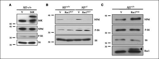 Figure 5. NPM expression is regulated by Rac1N17, but not S6K, in Nf1−/− astrocytes. A, overexpression of the mTOR downstream target S6K in wild-type astrocytes did not result in an increase in NPM expression. Phosphorylation of the S6K target ribosomal S6, but not total S6 protein, was increased in astrocytes overexpressing S6K. B, expression of Rac1N17 in Nf1−/− astrocytes decreases NPM expression but does not attenuate S6 phosphorylation. C, expression of Rac1V12 in Nf1+/+ astrocytes resulted in increased expression of NPM but did not alter S6 phosphorylation or total S6 expression. Arrowhead, expression of the myc-tagged Rac1V12 mutant protein in astrocytes infected with MSCV.Rac1V12. For all experiments, infection with empty MSCV (V) was included as a control.