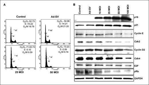 Figure 4. Effect of Ad-MMP-9 on cell cycle and cell cycle regulatory proteins. A, cell cycle analysis was done using flow cytometry as detailed in Materials and Methods. The labeled cells were analyzed using a FACSCalibur System. Percentage of cells in G0-G1, S, and G2-M phases were calculated using Cell Quest software. Data from a typical experiment repeated thrice. B, immunoblot of cell lysates corresponding to Daoy cells infected with mock, 100 MOI of Ad-SV, or the indicated MOI of Ad-MMP-9. Total protein lysates were analyzed for the levels of p21, p16, cyclin D2, cyclin E, cdk2, cdk4, pRb, and E2F-1. As detailed in Materials and Methods, the cells were infected with mock, 100 MOI of Ad-SV, or various doses of Ad-MMP-9, and total cell lysates were prepared for immunoblot analysis. Data from a representative experiment repeated thrice.
