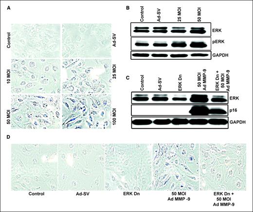 Figure 5. A, photographs of Daoy cells infected with Ad-MMP-9 stained for β-gal (pH 6.0) activity. B, effect of Ad-MMP-9 treatment on protein expression of ERK1/2 and pERK levels. Simultaneous treatment of Ad-MMP-9 infection and Dn-ERK mutant showed inhibition of ERK and p16 expression (C) and senescence marker SA-β-gal (D). Data from experiments repeated in triplicate.
