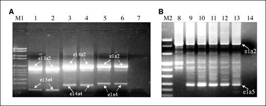 Figure 1. A and B, nested RT-PCR analysis (II step) of BCR/ABL alternative splicing in Ph-positive leukemic samples. Next to the main transcripts e1a2, e13a2, and e14a2, the following alternative transcripts can be seen: e1a4, e13a4, and e14a4 (A) and e1a5 (B). p210-positive samples (lanes 1–4); p190-positive samples (lanes 5 and 6 and lanes 8–13); negative controls (lanes 7 and 14). M1 size: 2,176, 1,766, 1,230, 1,033, 653, 517, 453, 394, 298, 234, and 154 (top to bottom); M2 size: 1,114, 900, 692, 501/489, 404, 320, 242, 190, 147, 124, 110, and 67 (top to bottom).