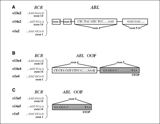 Figure 2. Alternative reading frame (ARF) of ABL gene into the splice variants involving BCR exon 1, 13, or 14 and ABL exon 4 or 5. A, normal reading frame of ABL exons 4 and 5 into e1a2, e13a2, and e14a2 fusion transcripts. B and C, ARF of ABL exons 4 and 5 into the OOF splice variants. All the three kinds of alternative splice junctions with abl exon 4 display the same ARF, as well as all those with abl exon 5.