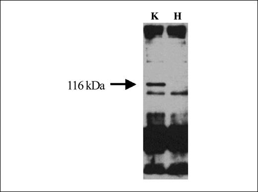 Figure 3. Western blot detection of 116-kDa Bcr/Abl-OOF fusion protein. Immunoprecipitation of K562 (K) and HL60 (H) radioimmunoprecipitation assay buffer extracts with rabbit polyclonal anti-OOF serum followed by immunoblotting with anti-Bcr mAb.
