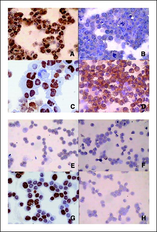 Figure 4. K562 (A–D) and HL60 (E–H) immunohistochemical staining. K562 (A) and HL60 (E) cell lines incubated with OOF antiserum (dilution 1:50); K562 (B) and HL60 (F) cell lines incubated with preimmune antiserum (dilution 1:50) as negative control; K562 (C) and HL60 (G) cell lines incubated with anti-Ki-67 antibody (dilution 1:50), as control of nuclear positivity; K562 (D) and HL60 (H) cell lines incubated with anti-Bcr antibody (dilution 1:200), as control of cytoplasmic positivity. A strong and homogeneous nuclear positivity in K562 can be seen with OOF antiserum staining (A), whereas no positive evidence is seen in HL60 (E). Original magnification, ×400.