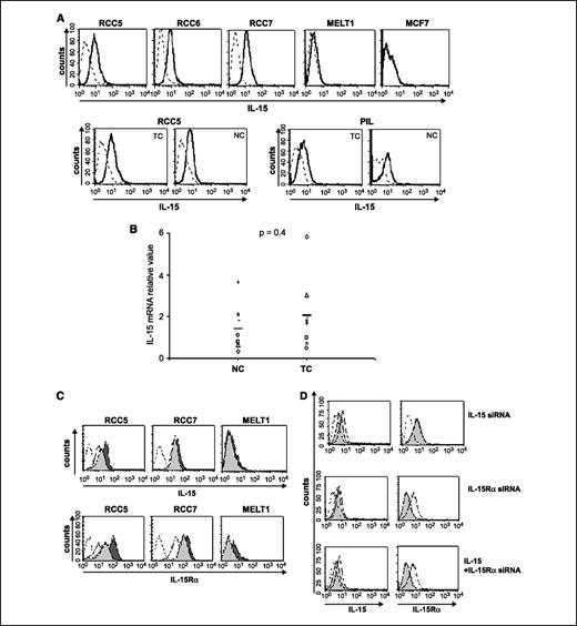 Figure 2. RCC cells express MbIL-15. A, renal tumor cell lines (three of six tested are shown: RCC5, RCC6, and RCC7) produce IL-15 (bold line), but breast cancer MCF7 and melanoma MELT1 cells do not. Paired tumor (TC) and normal (NC) cells produce similar levels of IL-15 (two of five pairs are shown: RCC5 and PIL). B, quantitative analysis of IL-15 mRNA transcripts in primary tumor and normal renal cell pairs derived from eight RCC patients. Results are expressed as IL-15 mRNA relative value (normalized to 18S mRNA of each cell line). P values between normal and tumor cells are indicated (Student's t test). C, staining of MbIL-15 and IL-15Rα (thin lines) in tumor cells treated with IFN-α (gray) and IFN-γ (black). Dashed lines, isotypic controls. D, RCC7 cells transfected with IL-15 siRNA, IL-15Rα siRNA, or both and labeled with anti-IL-15 and anti-IL-15Rα antibodies 24 h later.