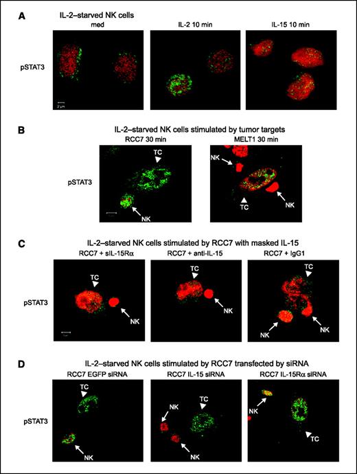 Figure 3. MbIL-15 on RCC cells induces IL-15 signaling in NK cells. A, NK cells were IL-2 starved for 6 to 8 h in cytokine-free medium (med) and stimulated in vitro with 300 units/mL IL-2 or 20 ng/mL IL-15 for 10 min. Cells were fixed, permeabilized, stained with anti-pSTAT3 or control mAbs, and analyzed by confocal microscopy. Green nuclear staining, pSTAT3 translocation. Nuclei are stained in red with TO-PRO-3. B, IL-2–starved NK cells (arrows) were incubated with tumor cells (arrowheads) for 30 min and processed as above. C, treatment of RCC7 cells with sIL-15Rα, anti-IL-15 mAb, or control IgG1 before their coculture with NK cells abrogated pSTAT3 nuclear translocation in starved NK cells. D, RCC7 (TC) cells transfected with IL-15 siRNA inhibited pSTAT3 nuclear translocation in IL-2–starved NK cells. IL-15Rα siRNA and EGFP siRNA had no effect.